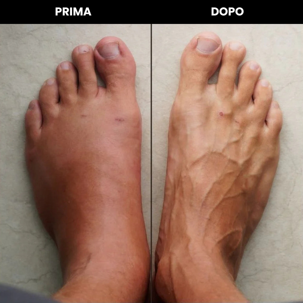 Fascia Ortopedica Riscaldante